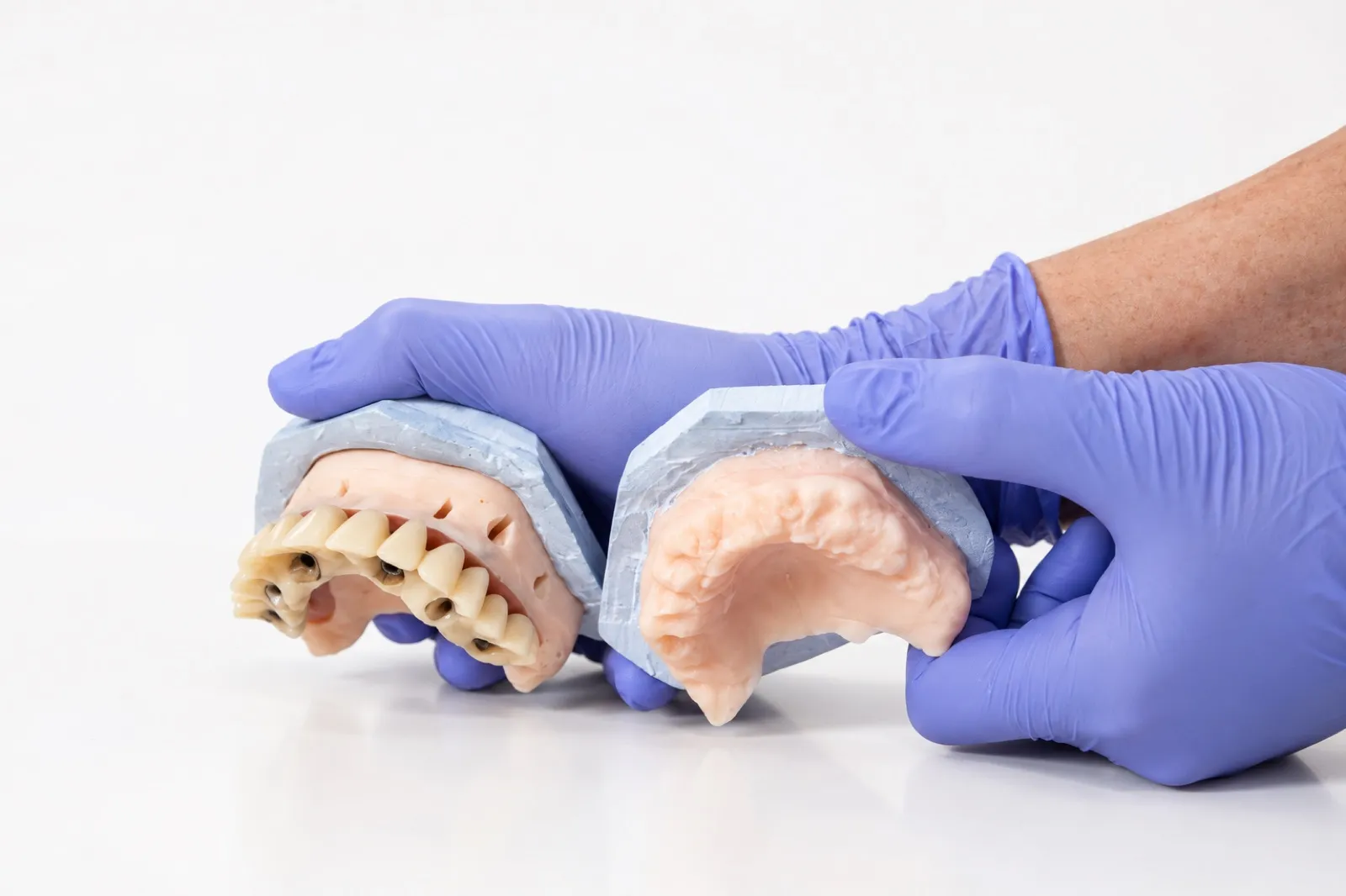 Cirugía e implantes
