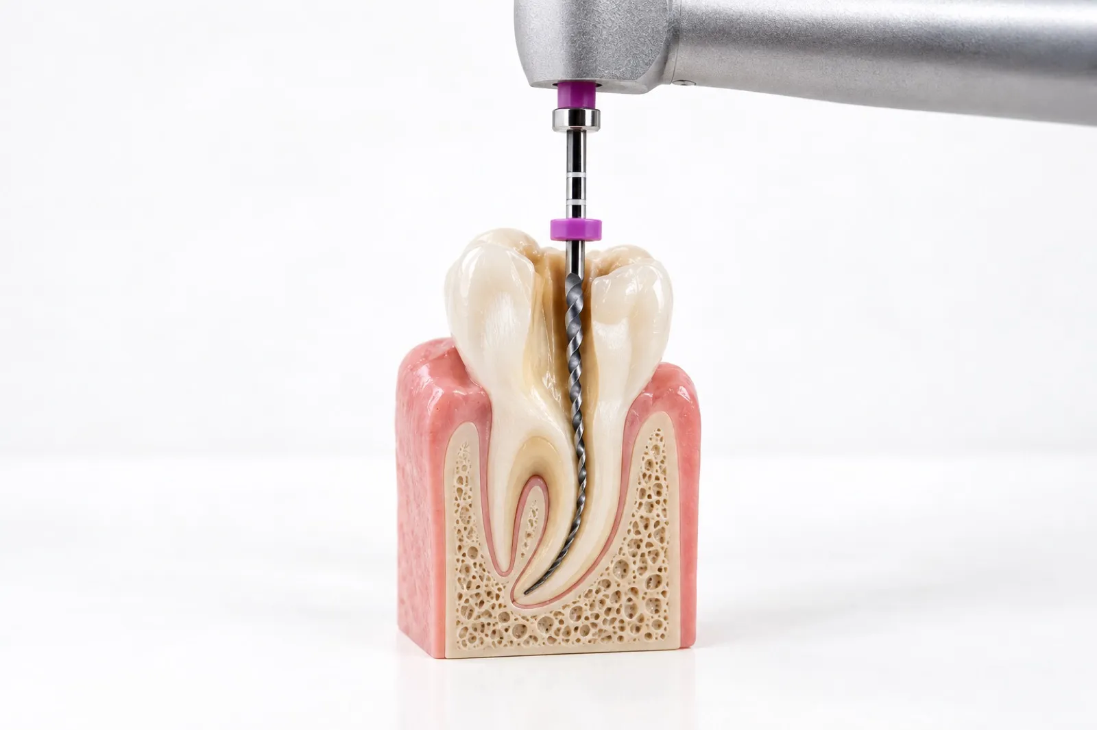 Endodoncia en la Clínica Dental Dra. Mª Jesús Crespo