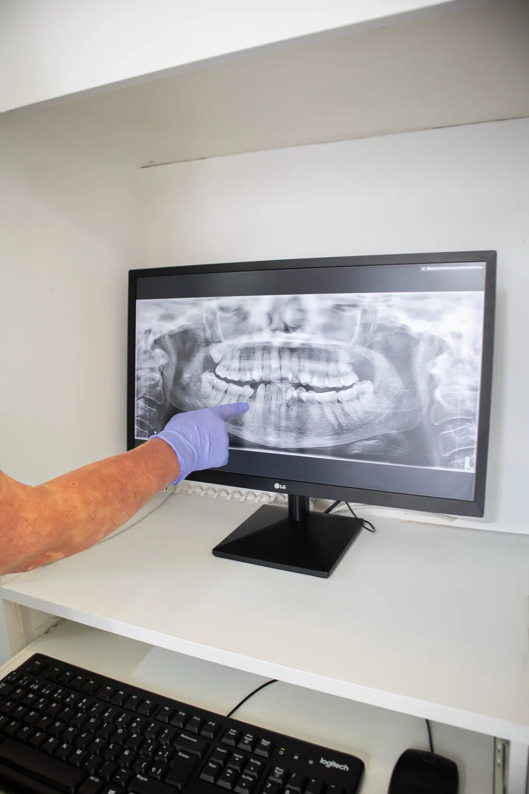 Odontología conservadora en la Clínica Dental Dra. Mª Jesús Crespo
